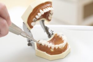 Dental Extraction