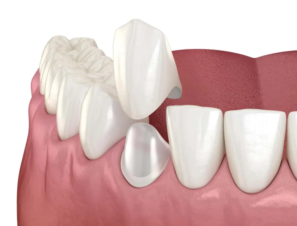 Restorative Dental Treatment