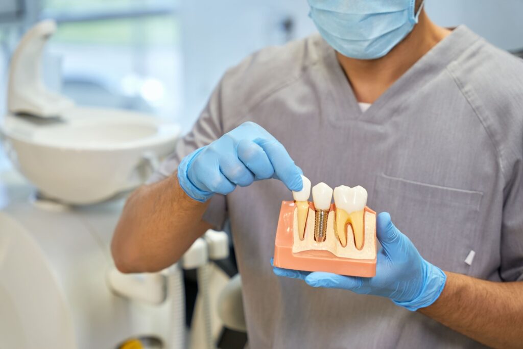 Dental Implants