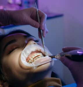 Emergency Dentist Near Miami FL