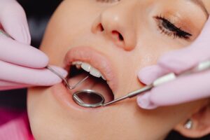 limpieza dental en Miami — visita preventiva e higiene profesional