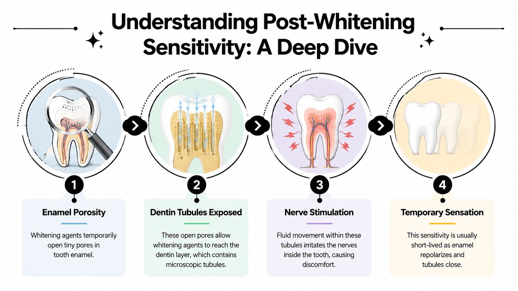 An infographic explaining the four-step biological process of how tooth whitening causes temporary post-treatment sensitivity.