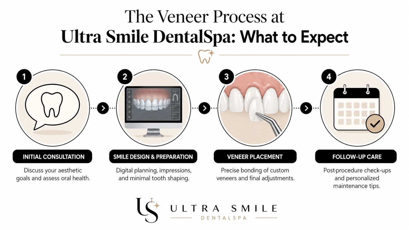 The Veneer Process at Our Miami Dental Spa What to Expect