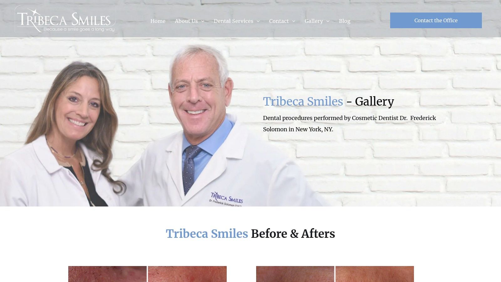 Case Study 7: The All-on-4® Full Arch Restoration