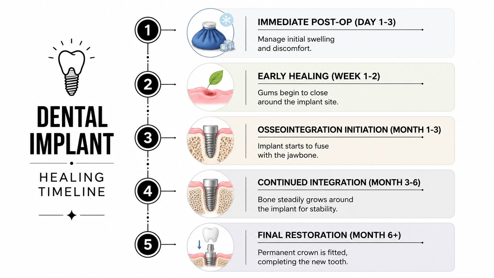 A dental implant healing timeline infographic illustrating five stages of recovery from post-op to final restoration.