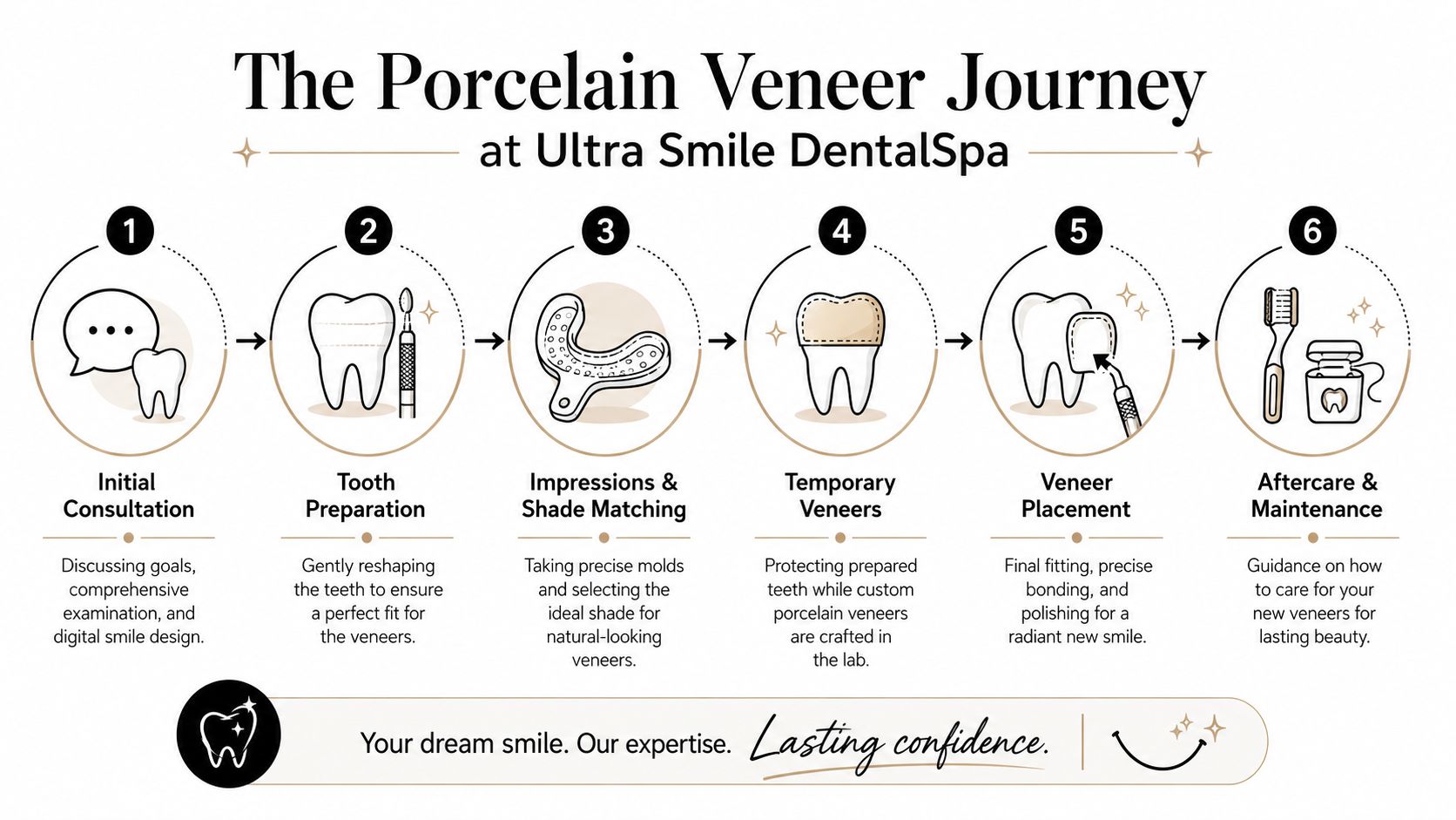 A six-step infographic detailing the professional porcelain veneer procedure process at Ultra Smile DentalSpa.