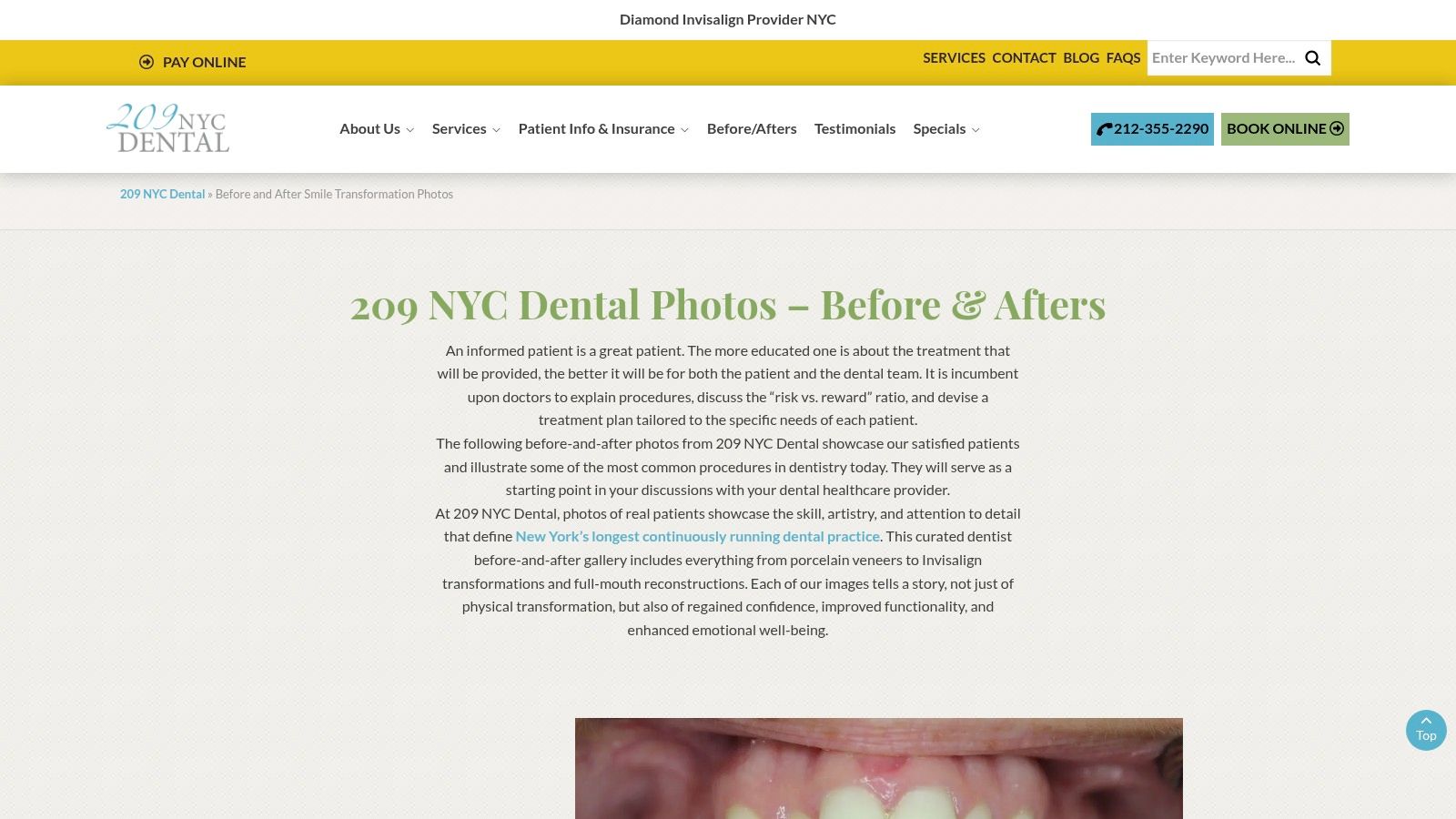 Case 5: Correcting Misshapen and Unevenly Sized Teeth