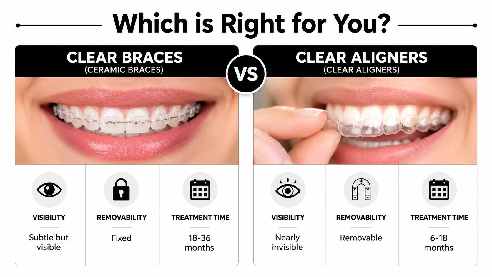A comparison table showing the visual differences and features of clear ceramic braces versus clear teeth aligners.