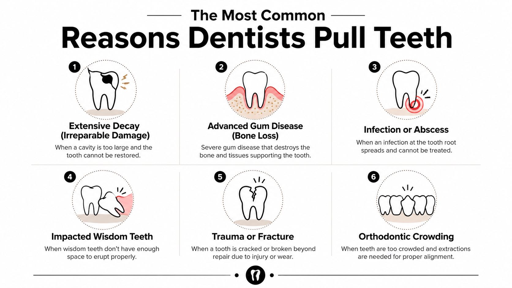 An infographic illustrating six common medical reasons why dentists perform tooth extractions for patients.