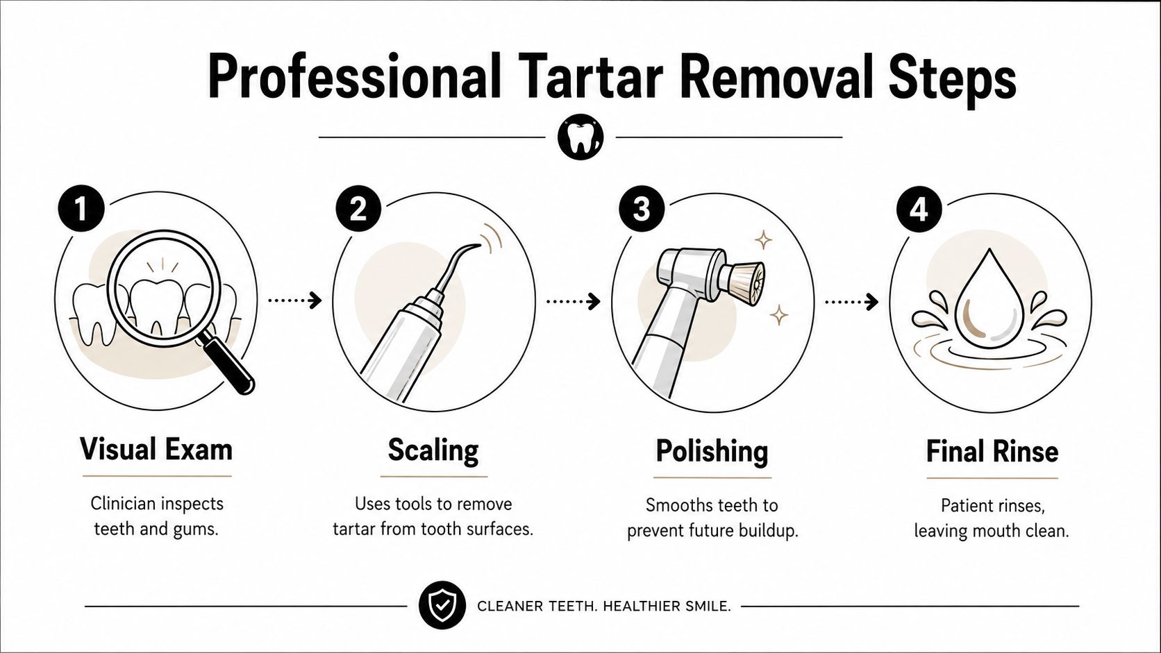 A four-step infographic illustrating the professional tartar removal process, starting with visual exam, scaling, polishing, and final rinse.