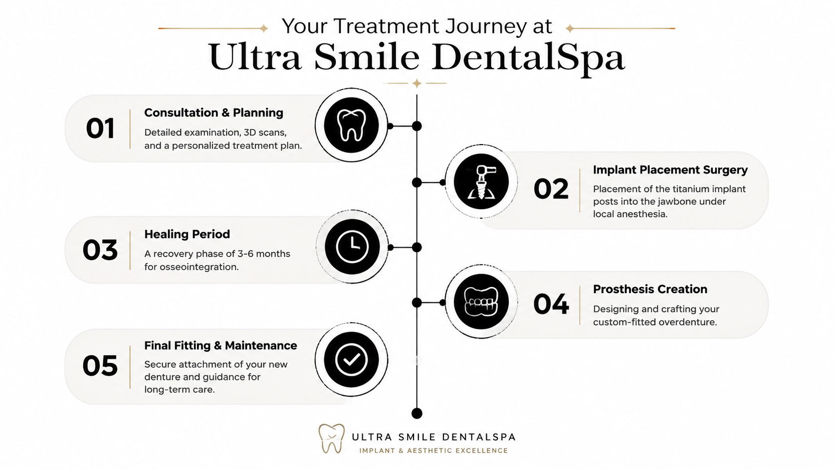 A step-by-step infographic illustrating the five stages of an implant-supported denture journey at Ultra Smile DentalSpa.