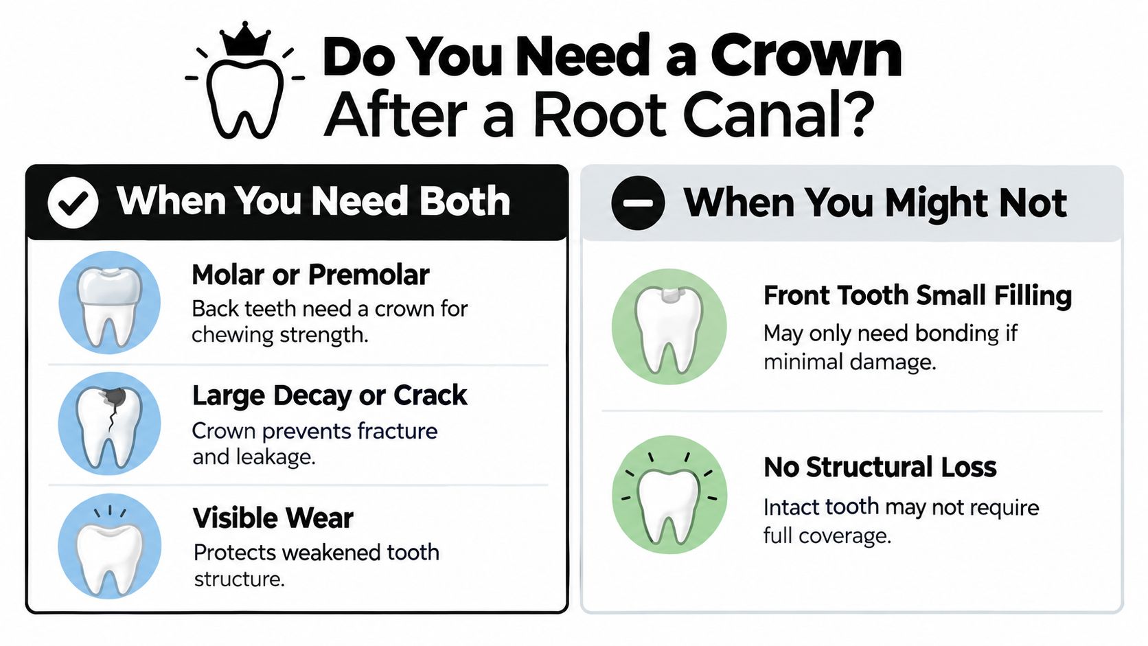 An infographic detailing when a dental crown is recommended versus when it might not be necessary after a root canal.