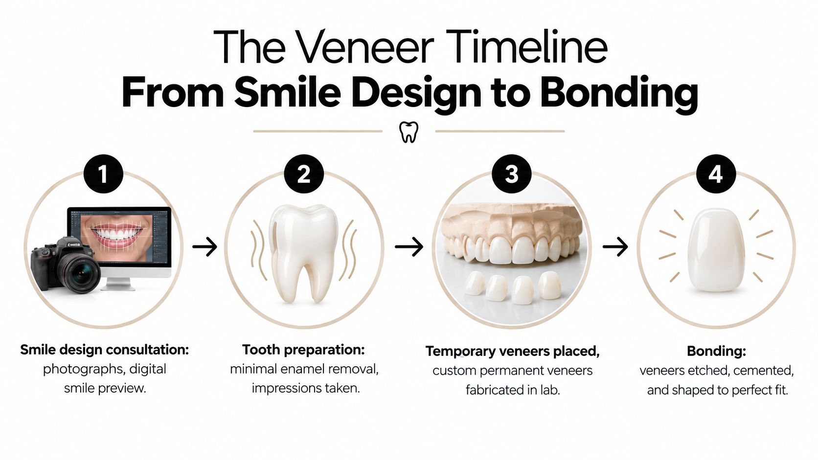 A four-step infographic illustrating the professional dental veneer process from initial smile design to final bonding.