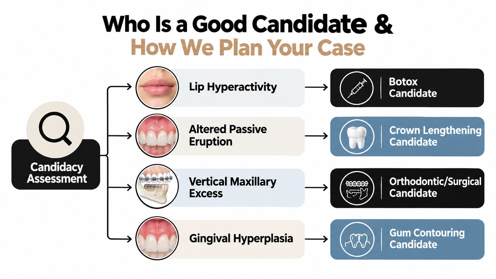 A diagnostic flowchart showing dental conditions related to a gummy smile and their corresponding treatment options.