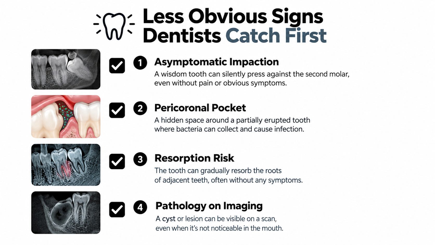 An infographic showing four common dental issues like impaction and cysts identified during wisdom tooth imaging.