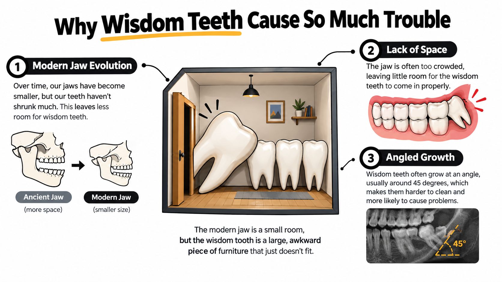 An infographic showing why wisdom teeth cause issues due to modern jaw evolution and lack of space.