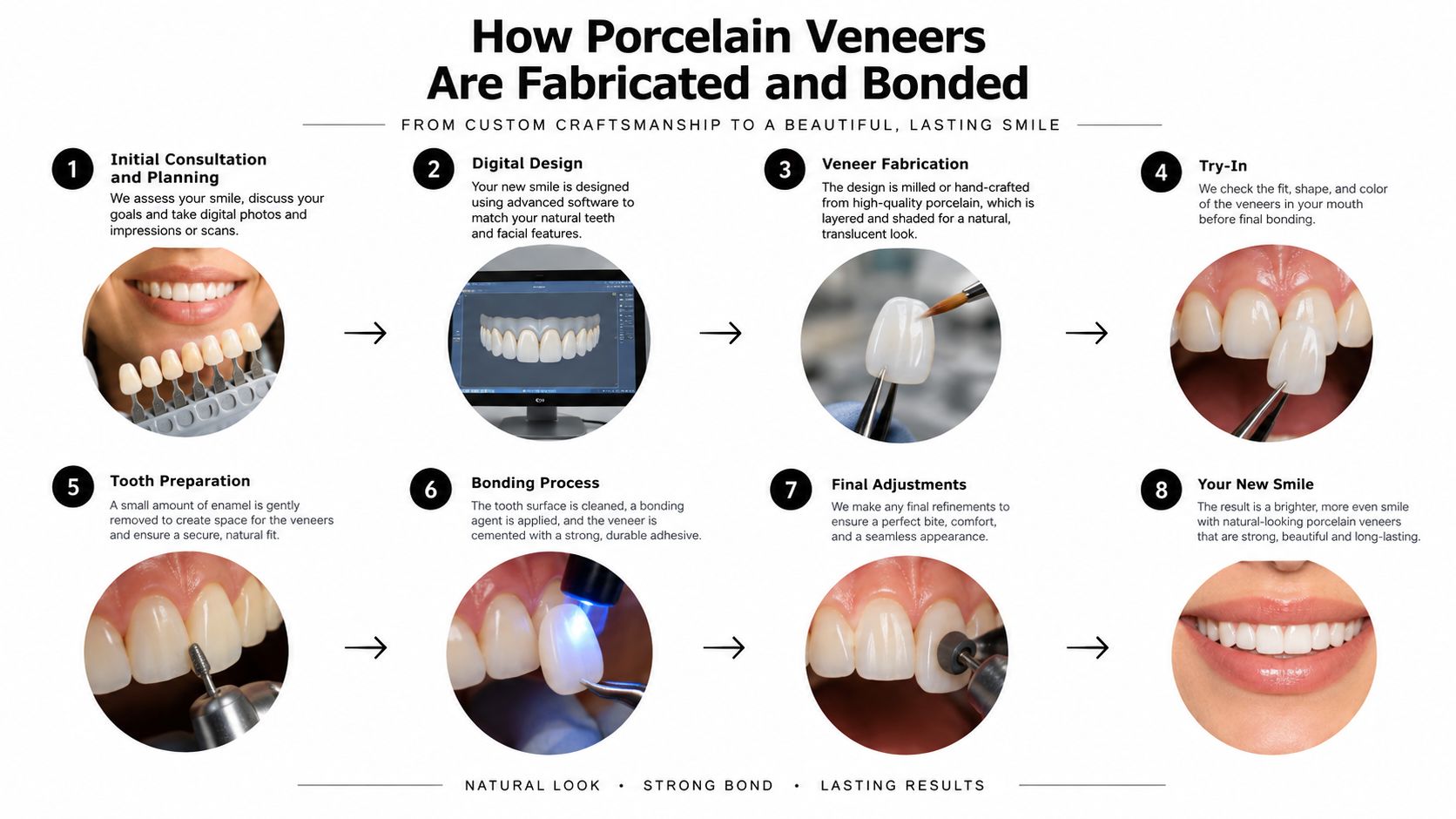 An infographic detailing the eight-step process of creating and applying porcelain veneers for a beautiful smile.
