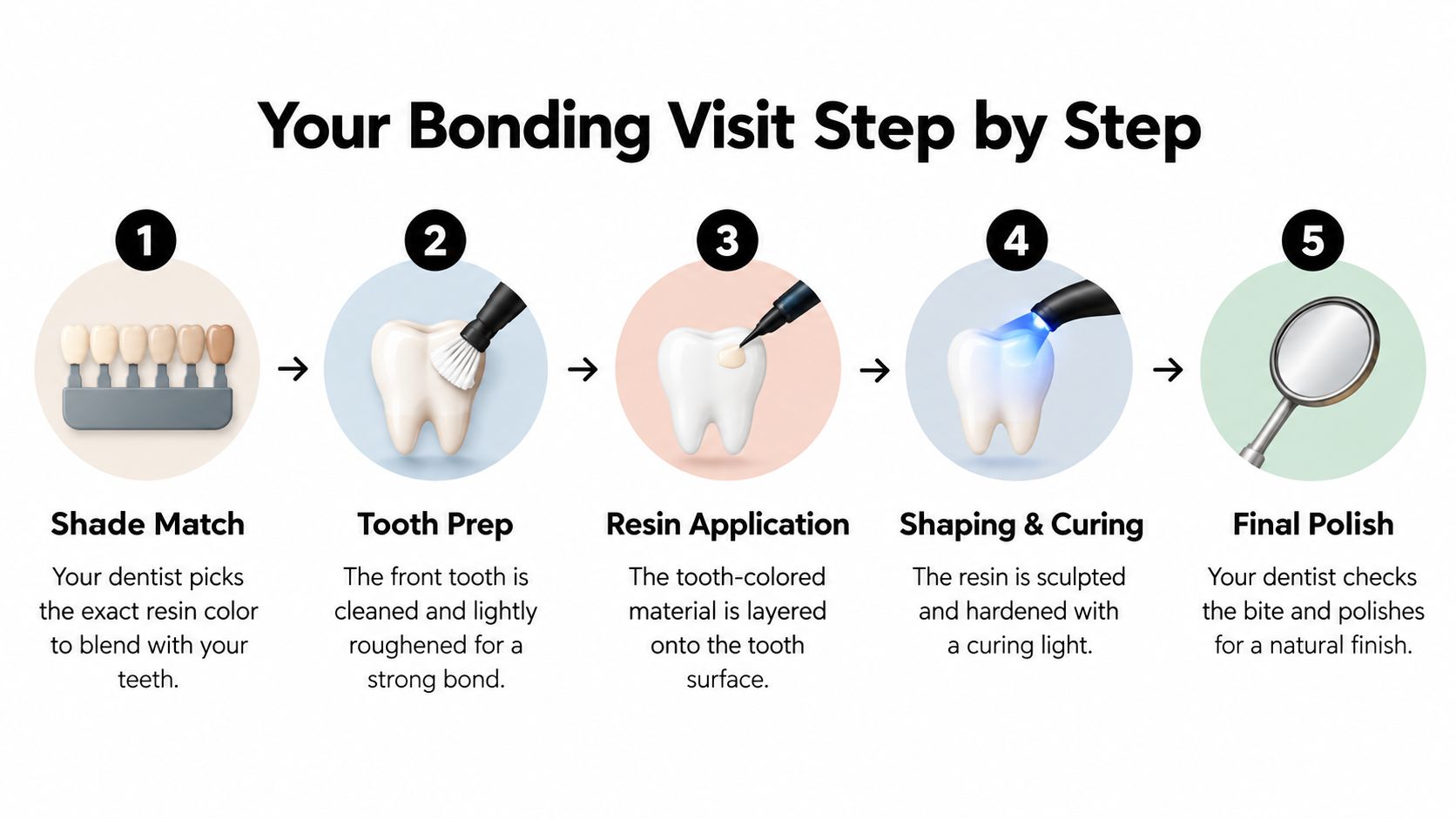 A five step infographic illustrating the dental bonding process from shade matching to the final polish.