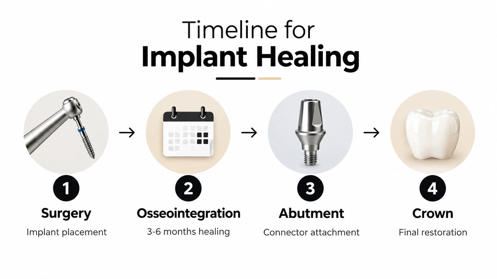 A diagram illustrating the four-step dental implant healing process from surgical placement to the final crown.