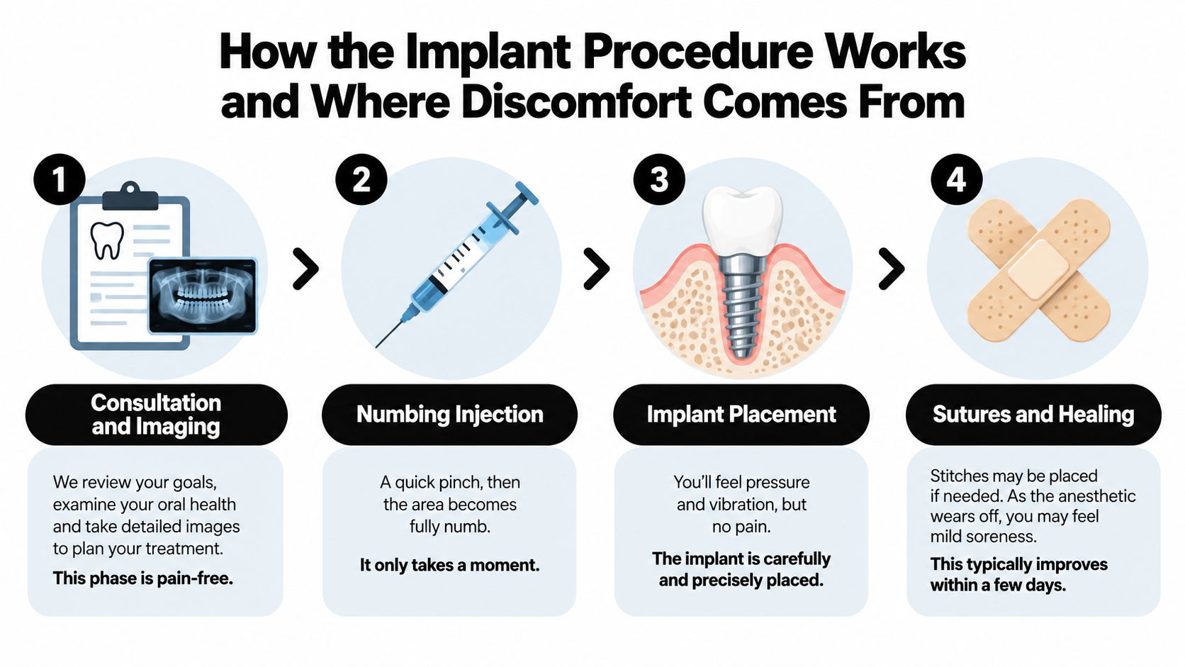 A four-step infographic explaining the dental implant procedure and when patients might experience discomfort during the process.