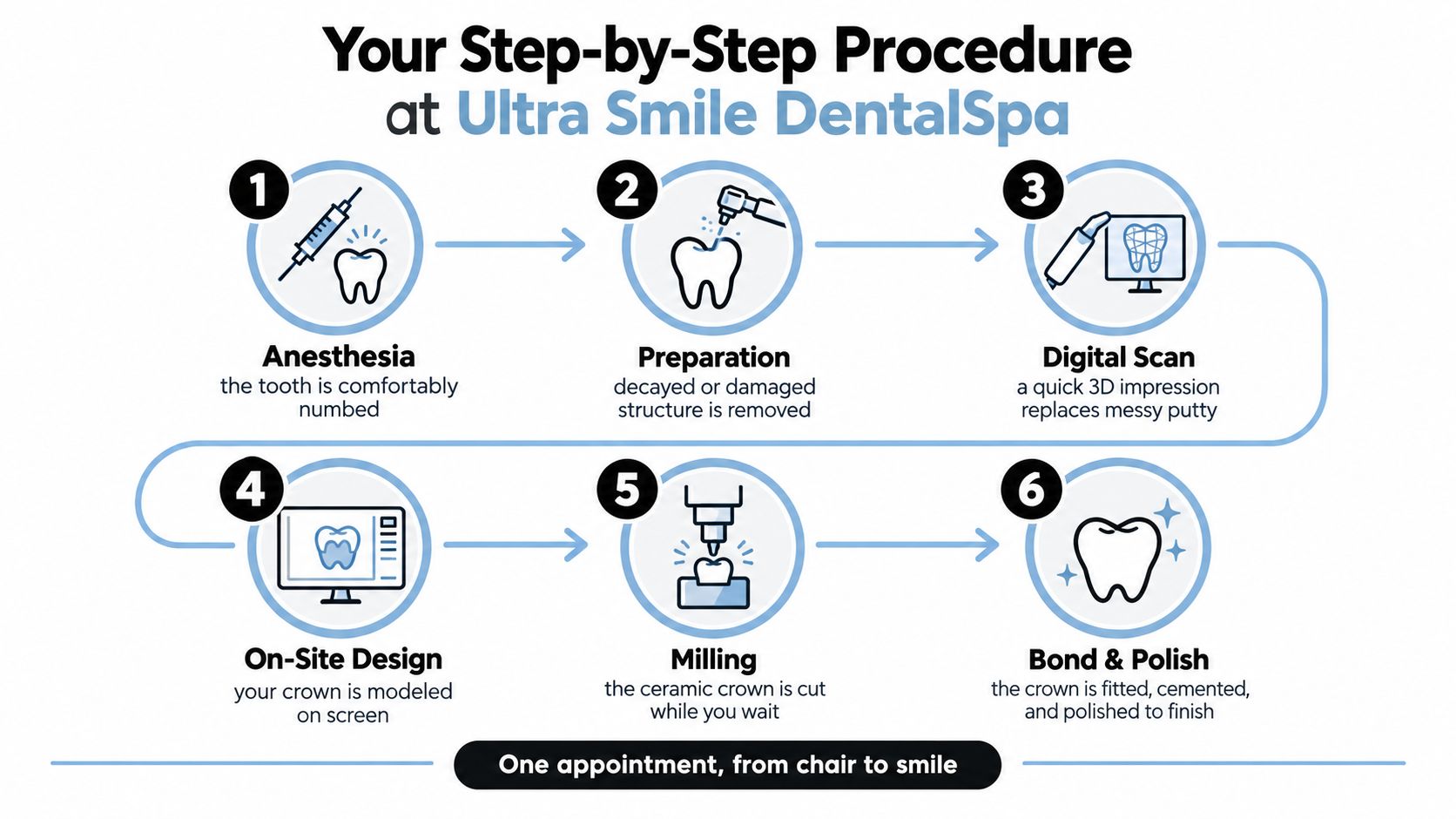 A six-step infographic detailing the Same Day Crown dental procedure performed at Ultra Smile DentalSpa.