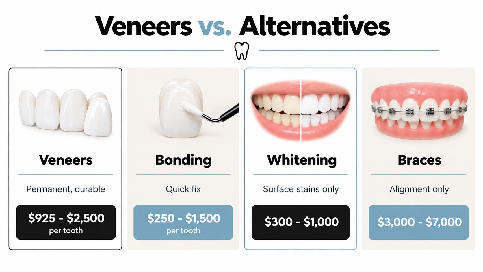 A comparison chart showing costs and features of veneers versus alternative dental procedures like bonding, whitening, and braces.