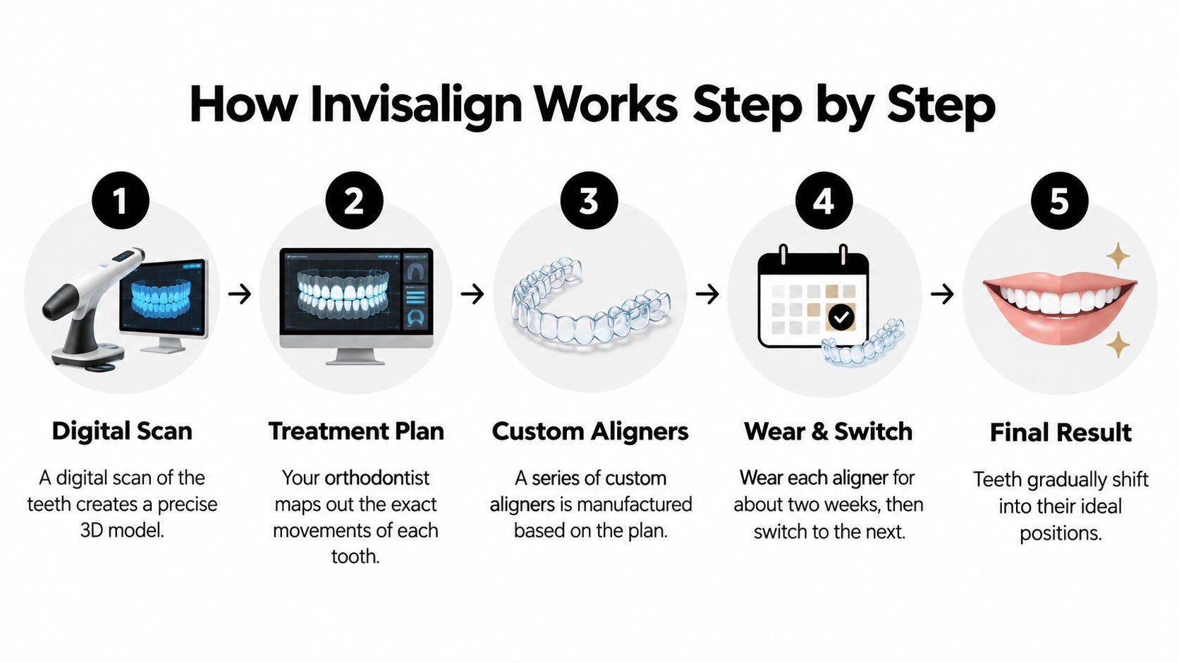 An infographic illustrating the five-step Invisalign treatment process, from digital scanning to achieving the final result.