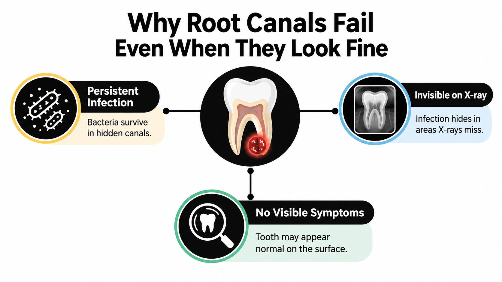 An infographic showing three main reasons why root canals can fail despite appearing healthy to patients.
